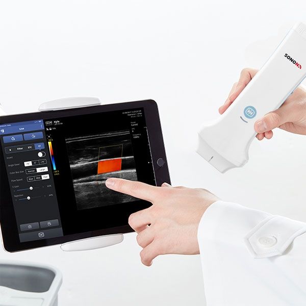 diagnostic-ultrasound-equipment